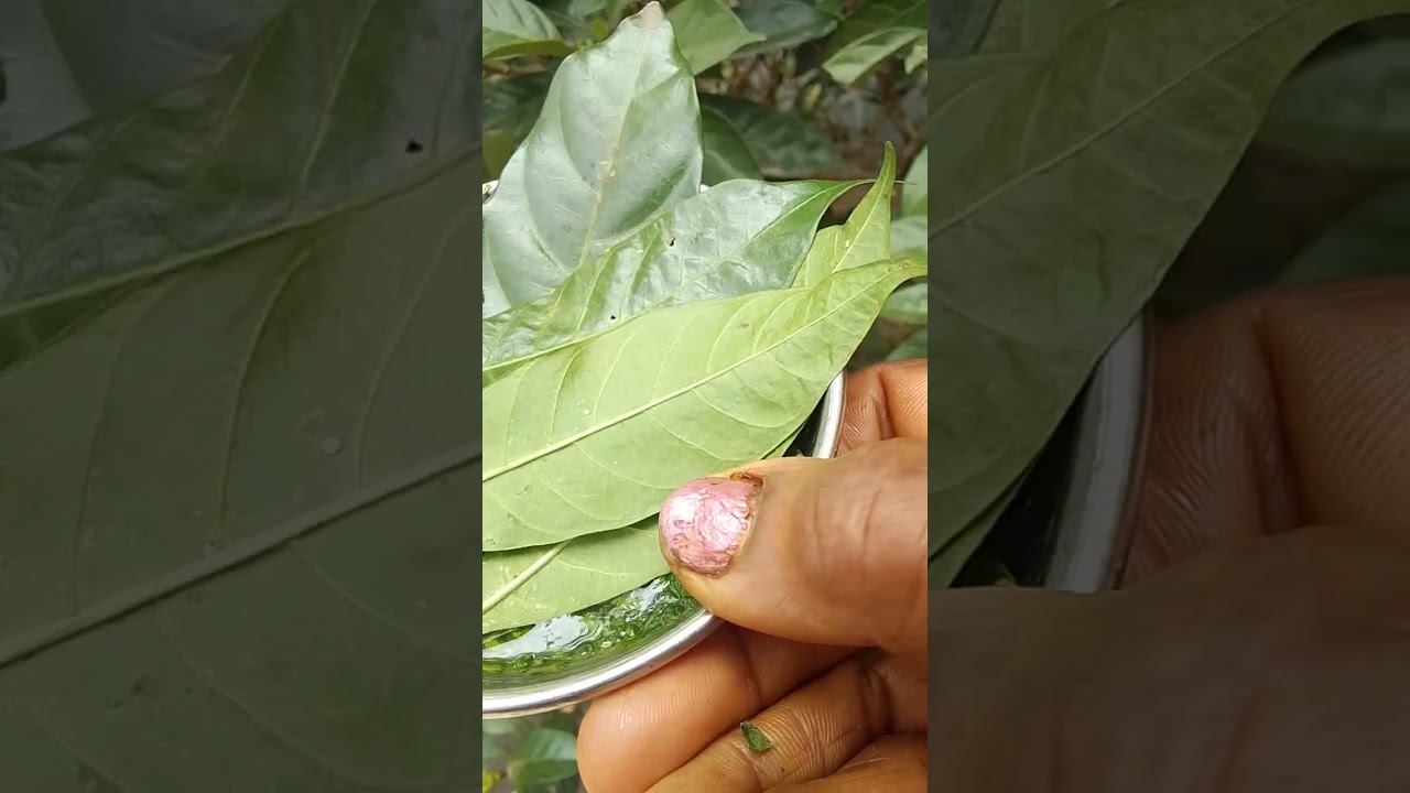 Tabernaemontana sps. Grape jasmine@ 🤩Eye pain relief😅