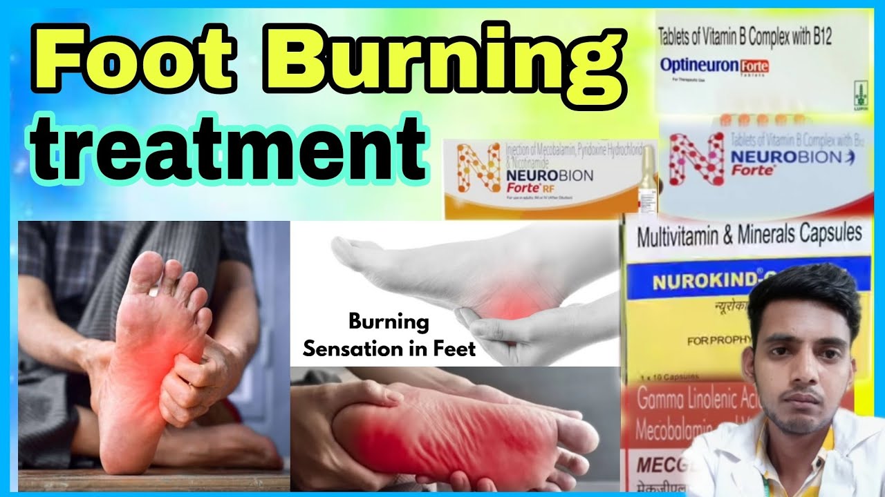 Foot Burning treatmentfoot burning ka ilaj kaise kare foot burning
