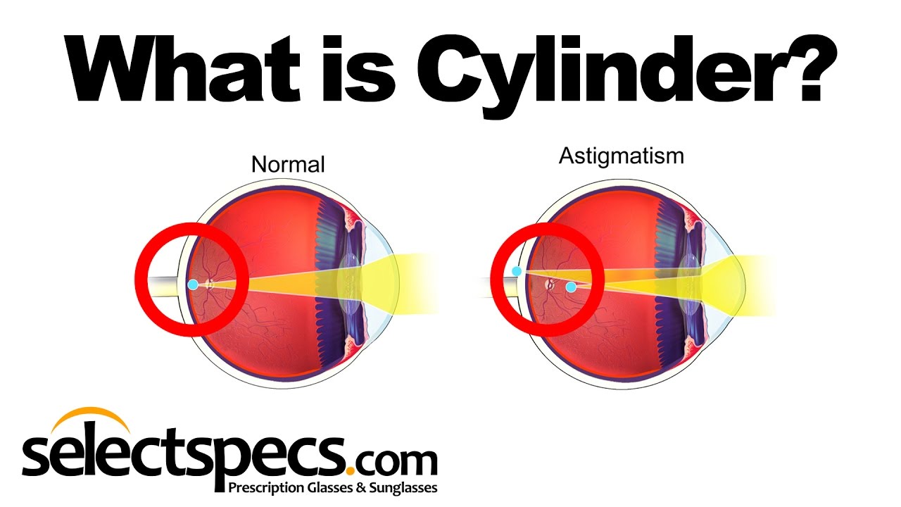 Kết quả hình ảnh cho cylinder eye"