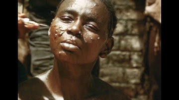 African Trypanosomiasis (U.S. Naval Photographic Center, 1951)