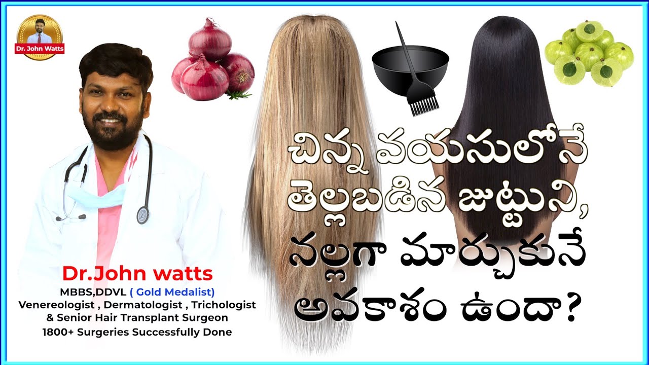 చిన్న వయసులోనే తెల్లబడిన జుట్టుని, నల్లగా మార్చుకునే అవకాశం ఉందా? | Dr.John Watts