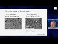 Scientific Updates on Organic Acidemias and Homocystinurias - Session 1