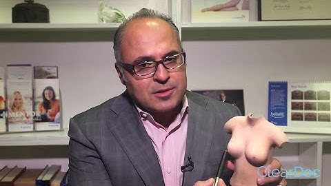 How is a Breast Lift Performed? - Dr. Kevin Tehrani