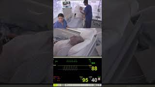 COPD Exacerbation Simulation – Managing the Deteriorating Respiratory Patient