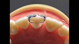 World’s First Truly Anatomical Matrix | Bioclear TSS