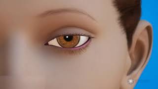 Chirurgie De Lectropion Et De Lentropion - Repositionner La Paupière