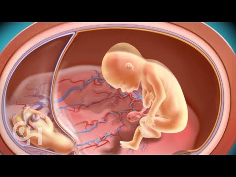 Poliklinika Harni - IUGR - Fetalni zastoj u rastu