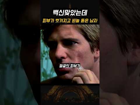 백신인줄 알고 맞았더니 온몸에 비늘이 돋음...? 😱