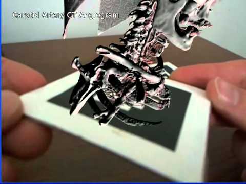 Marker-based augmented reality with direct volume rendering