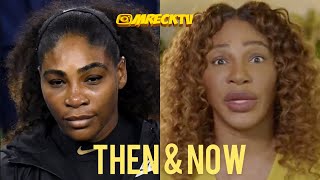Serena Williams & Many Celebrities Accused Of Lightening Their Skin|The Skin Bleaching Effect|Spooky