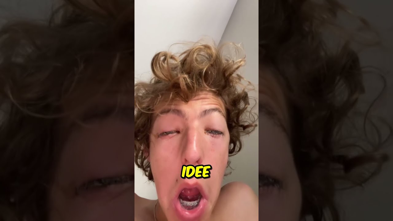 Hij Kon Zijn Ogen Niet Openen Na Een Dutje Shorts