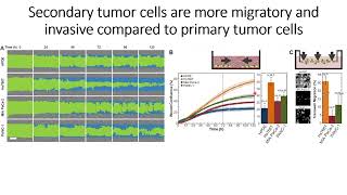 Secondary pancreatic tumors are more migratory and invasive compared to primary tumors #Code: 1207 Secondary pancreatic tumors are more migratory and invasive compared to primary tumors #Code: 1207