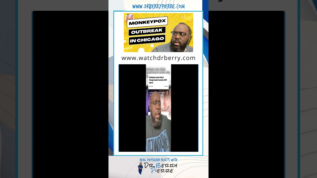 Monkeypox Outbreak in Chicago