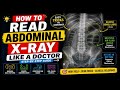 How to Read Abdominal X-Ray Like a Doctor 🩻Simple Trick to Read Abdominal X-Rays