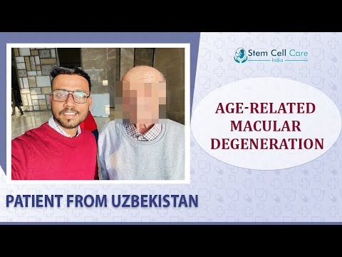 Patient with Age-related Macular Degeneration shares his experience at SCCI| Stem Cell for ARMD