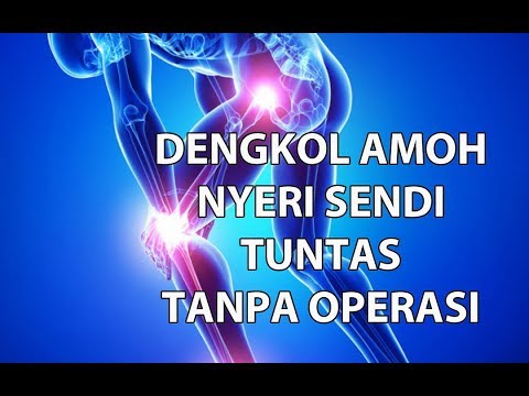 Obat Herbal Nyeri Sendi Ampuh Solusi Dengkol Amoh dg Alga Gold Alga kirei Obat Herbal Nyeri Sendi Ampuh Solusi Dengkol Amoh dg Alga Gold Alga kirei