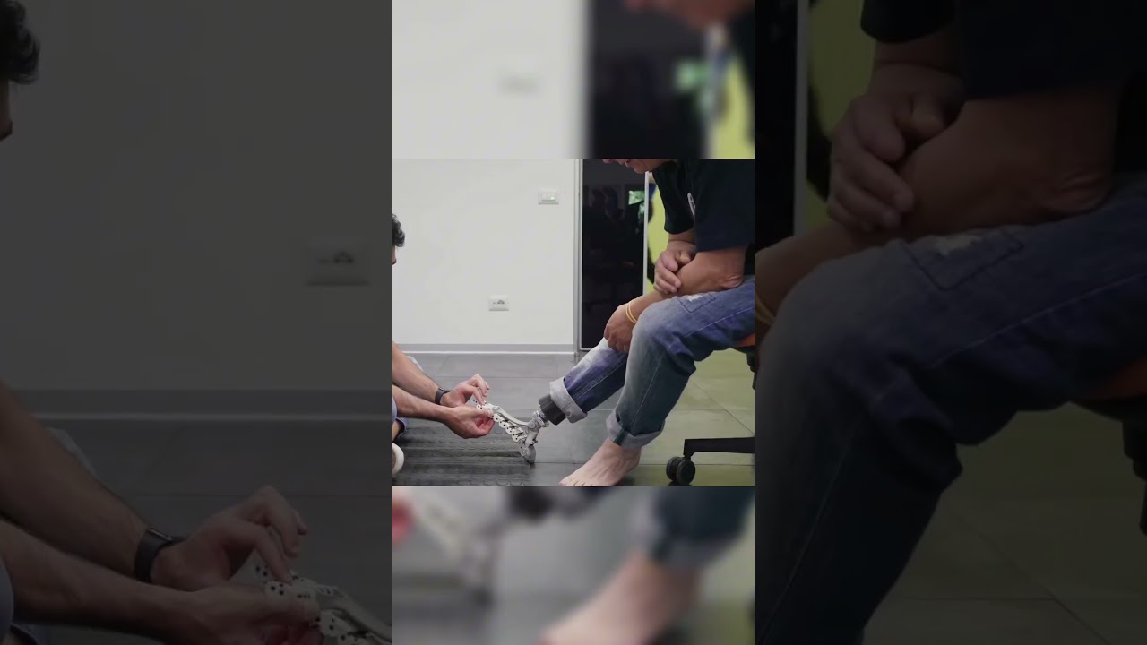 Гениальный протез 🦾