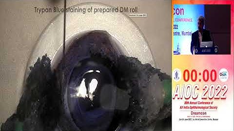 AIOC2022 IC45 Topic Dr  SAMAR KUMAR BASAK DONOR DM GRAFT PREPARATION AND BASIC STEPS IN DMEK