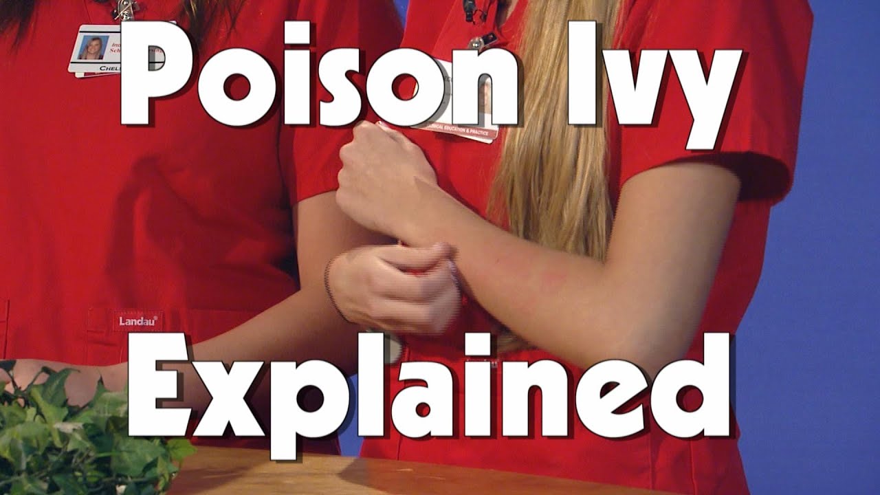 Poison Ivy | Kids Health | The Friday Zone | WTIU | PBS