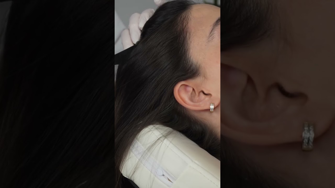 Полное ASMR-видео по чистке ушей, осмотру кожи головы и тела смотрите на моем канале 