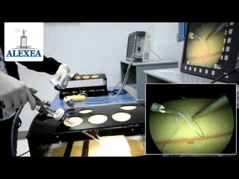 #2 TIPS & TRICKS FOR LAPAROSCOPIC SUTURES (Push to the knot technique)