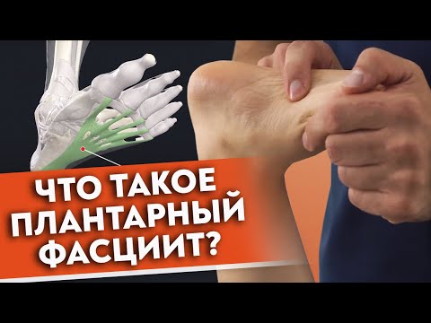 Болит пятка — что делать? | Плантарный фасциит: причины заболевания и срочная самопомощь