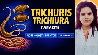 Trichuris Trichiura Whipworm Morphology, Life Cycle & Lab Diagnosis हनद म