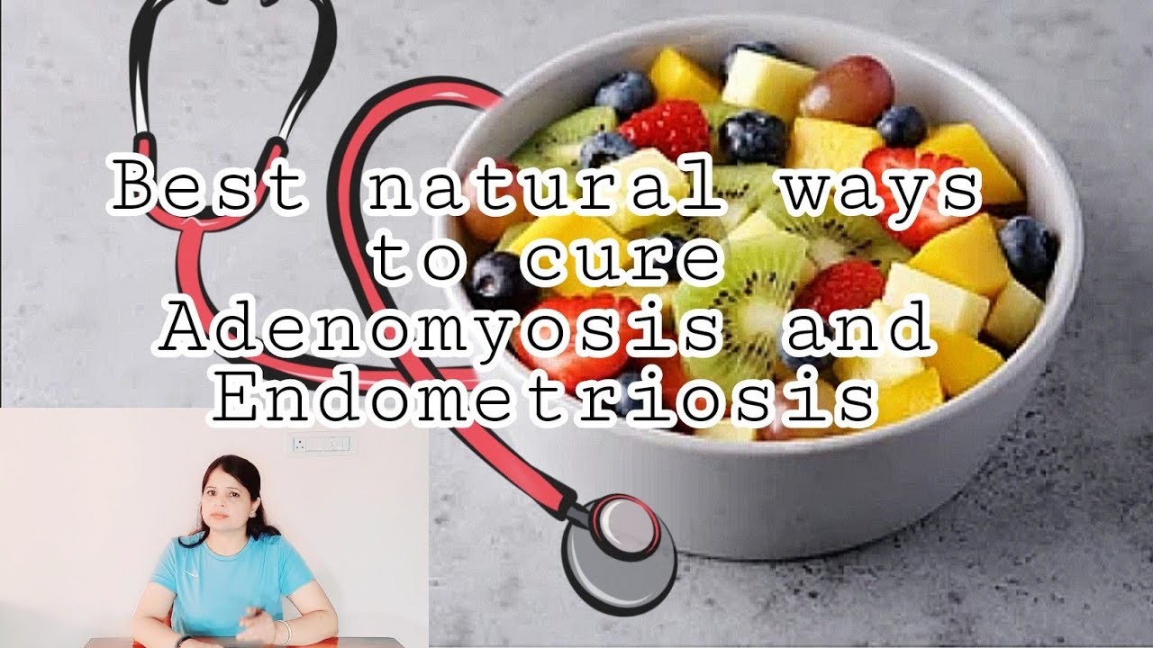 Best natural ways to cure Adenomyosis and Endometriosis # ...