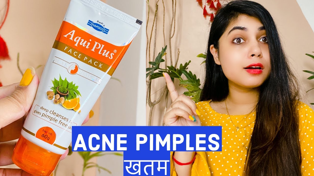 Remove Acne, pimples in 1 week! Acne removal face pack! SuhaniStyleTips