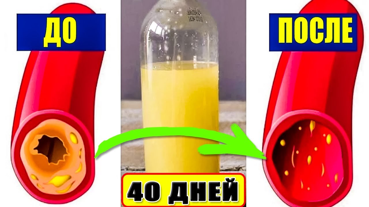 Всего 1 стакан этого сока Вычистит сосуды от Холестерина за 40 дней без лекарств дома.