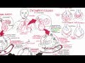 Emphysema - Pathophysiology (COPD)
