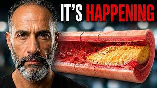 6 Warning Signs Your Arteries Are in Trouble on Carnivore