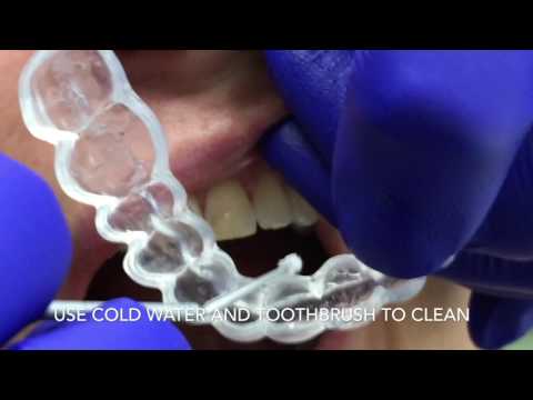 ENLIGHTEN TEETH WHITENING