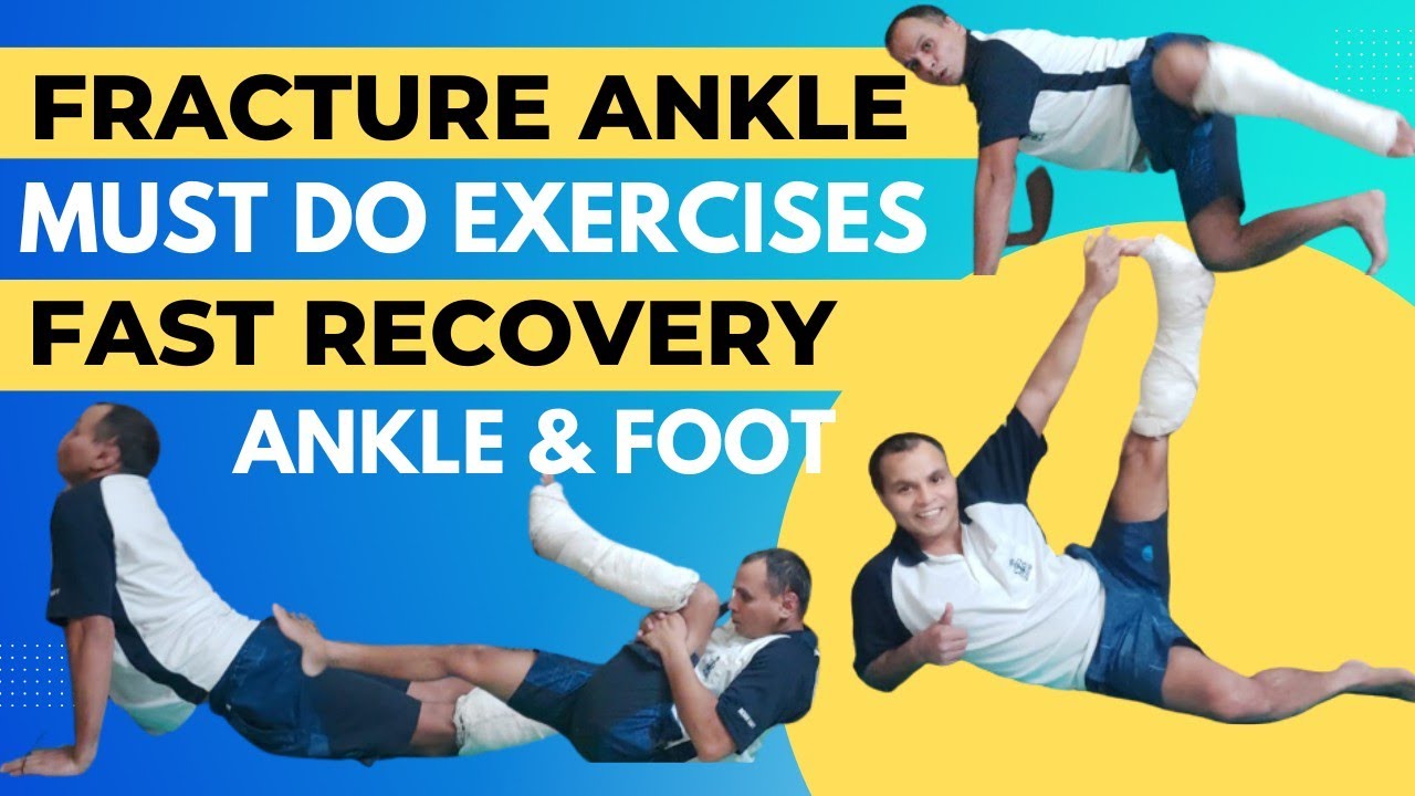 Fracture Ankle Fracture Foot & Fibula Recover Fast MUST Do