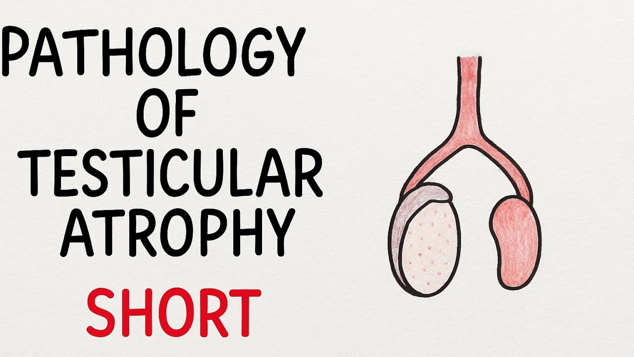 Testicular Atrophy Pathology | Short & Simple Revision for Nursing Students