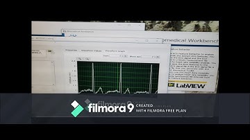ECG Acquisition using NI  Elvis
