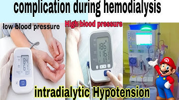 Hypotension During Dialysis | Hypertension And Hypotension explanation | Complication Of Dialysis