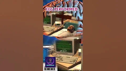 EEG Test Performed : Brain Activity Monitoring Explained