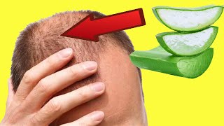 Como Tratar La Psoriasis En El Cuero Cabelludo Con Remedios Naturales Part 2