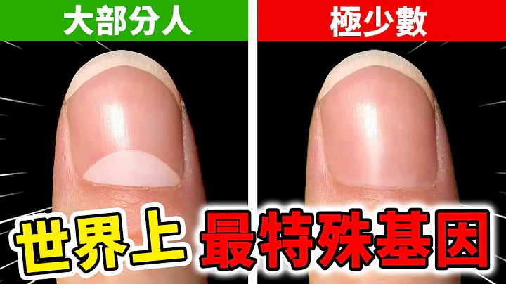 世界上最特殊的10個身體特徵！超強能力全球不到50人，擁有第一名千萬別和其他人說！| 好奇指南針 #生活 #天賦 #有趣  #科普 #top #top10 - 天天要聞