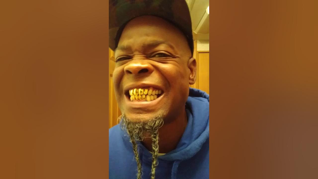 How I Clean my Gold Teeth and Why I have Them by Black Feniks YouTube