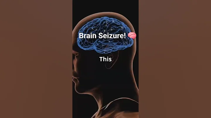 What a Seizure Looks Like Inside Your Brain