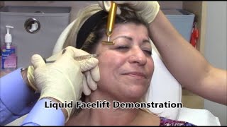 Liquid Facelift Demonstration 1 - A E Skin - Encino, CA - 818-835-1833