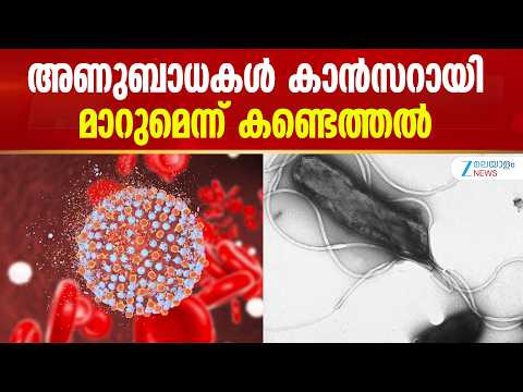 Cancers by Infection | അണുബാധകള്‍ കാൻസറായി മാറുമെന്ന് കണ്ടെത്തൽ
