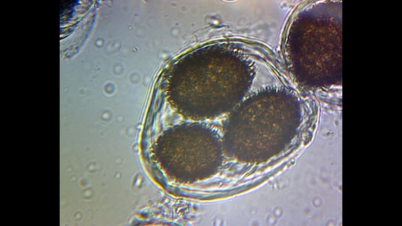 Wild Black Truffle spores, Tuber Melanosporum YouTube