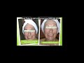 HIFU-Ultherapy.com