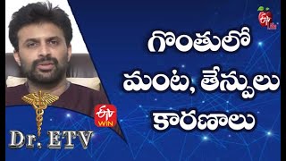 Sore Throat - Causes |గొంతులో మంట, తేన్పులు - కారణాలు|Dr.ETV | 23rd  September 2021 | ETV Life