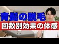 髭脱毛の回数別の効果の体感の目安と早く終わらせる為のポイントを解説!