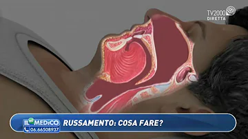 Cosa fare per smettere di russare?