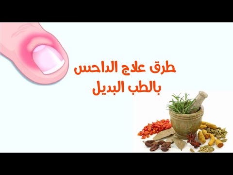 فيديو: 3 طرق لعلاج الداحس